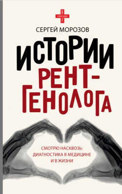 История рентгенолога. Смотрю насквозь: диагностика в медицине и в жизни - Морозов Сергей